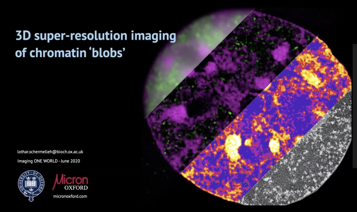01st June 2020: '3D super-resolution microscopy of chromatin ‘blobs’' - Lothar Schermelleh, MICRON, Oxford, UK's image