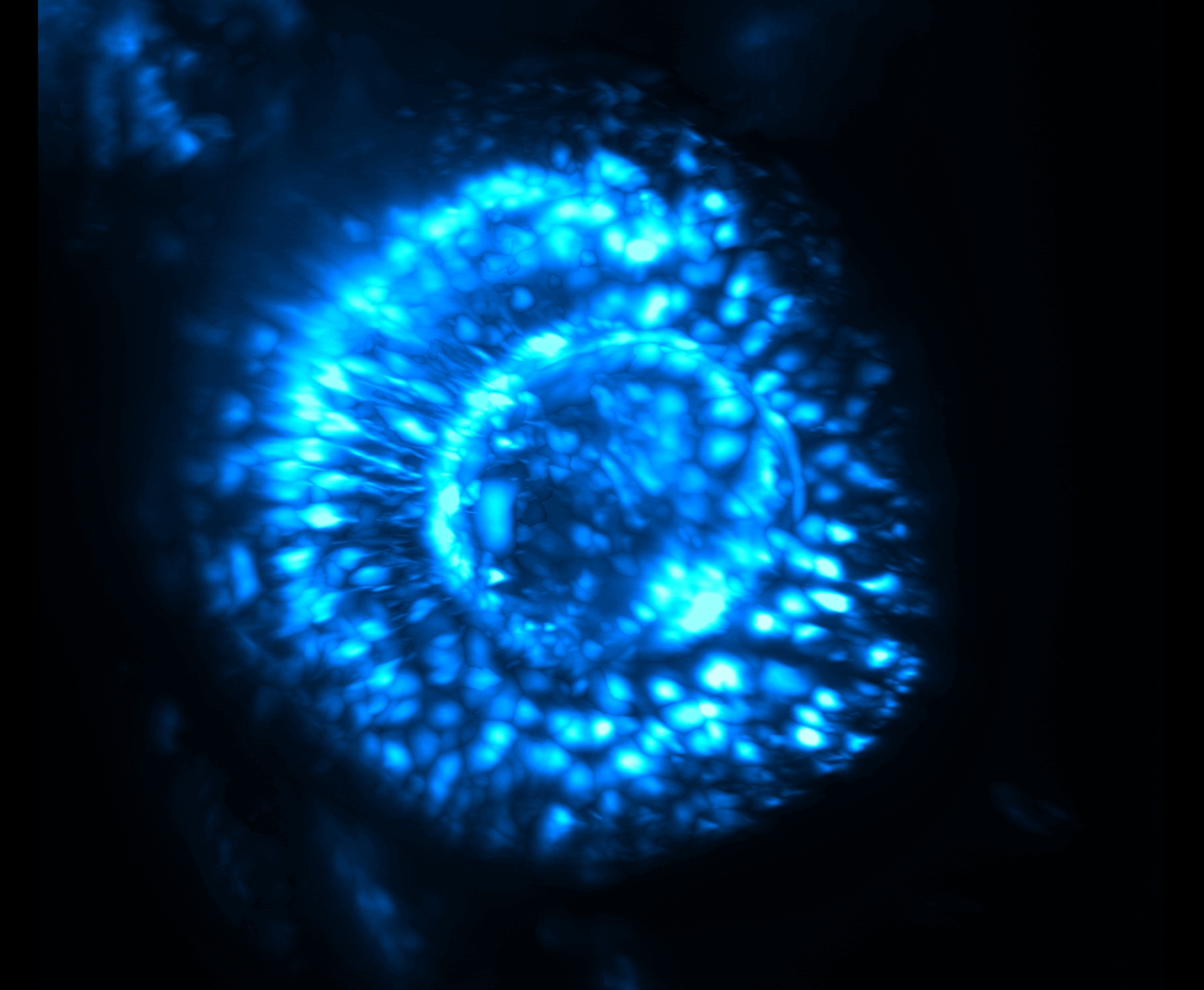 Zebrafish Eye, Light Sheet Imaging, Venus, 3d Rotational View's image