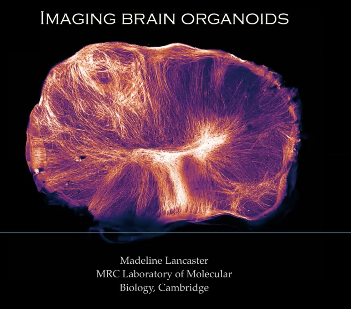 08th June 2020: 'Imaging Brain Organoids' - Madeline Lancaster, MRC LMB, Cambridge, UK's image